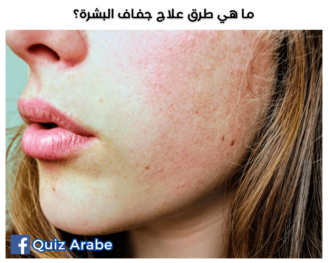 ما هي طرق علاج جفاف البشرة